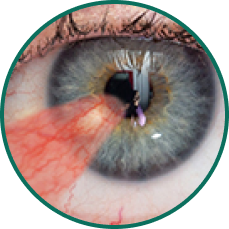5 close-up eye images depicting 5 ocular conditions that may result in or be associated with persistent epithelial defects