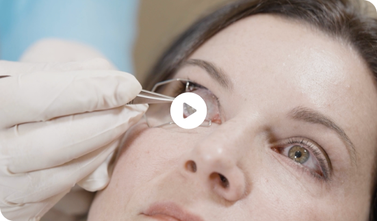 Ocular surface diseases or epithelial defects